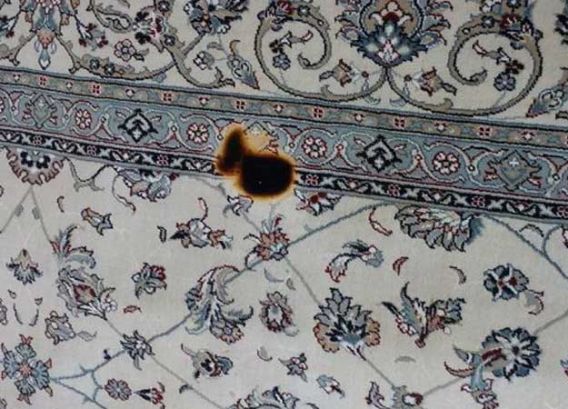 رفع سوختگی